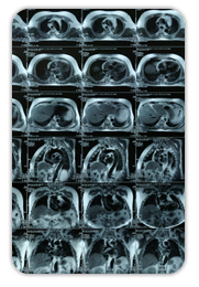 Private lung infection clinic london